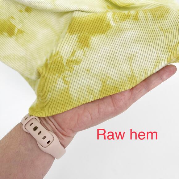 Enza Costa REVOLVE Tie Dye Tank Dress Bodycon Silhouette NEW Size M Yellow White - Picture 3 of 9